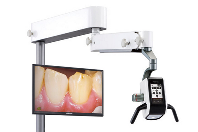 デジタルマイクロスコープ