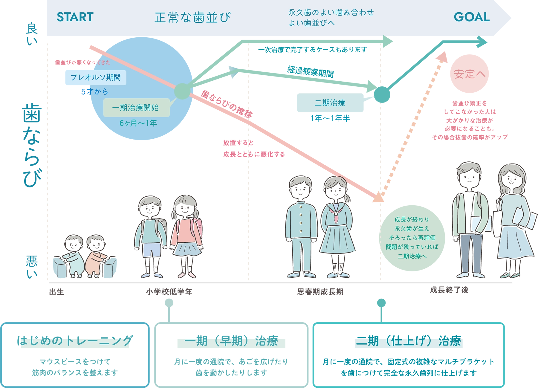 小児矯正のステップ