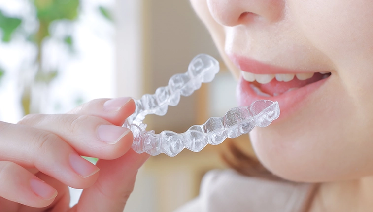 歯のクリーニング　アタッチメント装着